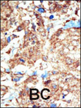 Rabbit Polyclonal Antibody to EphB1