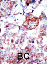 Rabbit Polyclonal Antibody to ILK1/ILK2 (N-term)