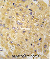 Rabbit Polyclonal Antibody to ILK1/ILK2 (N-term)