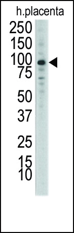 DDR1 (N-term)