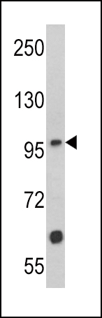 MUSK (N-term)