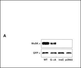 Rabbit Polyclonal Antibody to MUSK (N-term)
