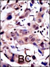 Rabbit Polyclonal Antibody to MUSK (N-term)