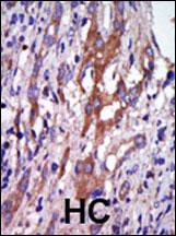 Rabbit Polyclonal Antibody to AIK (N-term)