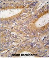 Rabbit Polyclonal Antibody to AIK (N-term)