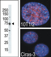 RSKB (MSK2) (C-term R321)
