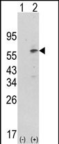 PDK1 (N-term)