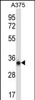 AMPK beta2 (PRKAB2) (N-term)