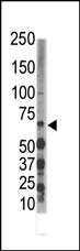 DYRK3 (N-term)