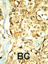Rabbit Polyclonal Antibody to TNIK (N-term)