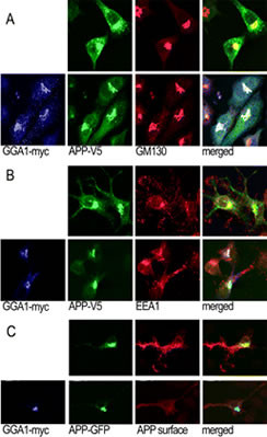 Rabbit Polyclonal Antibody to GGA1 (N-term)