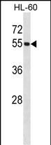 Rabbit Polyclonal Antibody to UBE1C