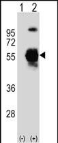 Rabbit Polyclonal Antibody to UBE1C