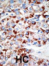 Rabbit Polyclonal Antibody to UBE1C