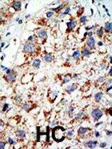 Rabbit Polyclonal Antibody to SAE2 (UBA2) (C-term E616)