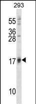Rabbit Polyclonal Antibody to ISG15 (N-term)
