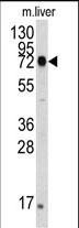 HSPA5