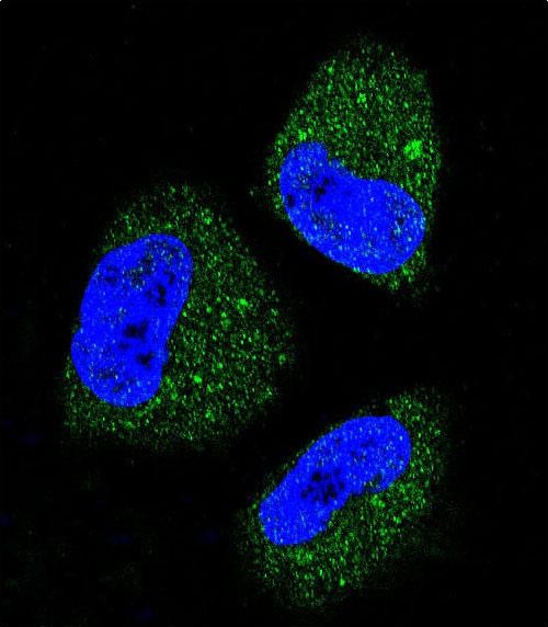 Rabbit Polyclonal Antibody to HSPA5