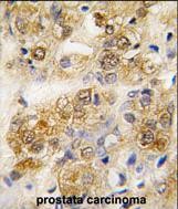 Rabbit Polyclonal Antibody to HSPA5