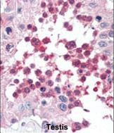 Rabbit Polyclonal Antibody to HSPA5