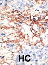 Rabbit Polyclonal Antibody to CEM15 (N-term)