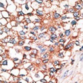 Rabbit Polyclonal Antibody to GJA10