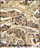 Rabbit Polyclonal Antibody to NCS1