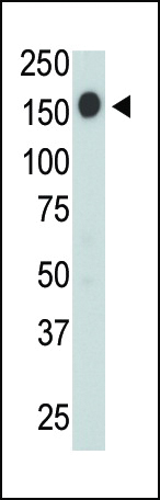 CD45