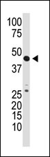 GDF3 (N-term)