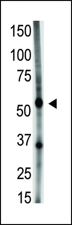 GDF5 (N-term)
