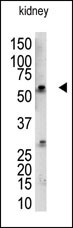 RBCK1 (UBCE7IP3) (N-term)