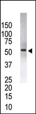 USP14 (N-term)