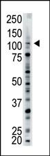 USP15 (N-term)