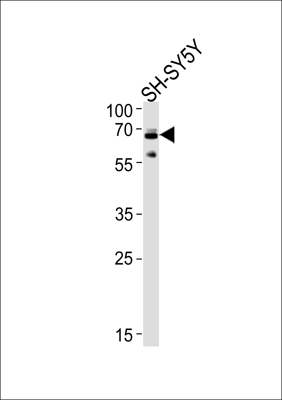 Ubiquilin1