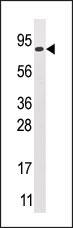 GCS1 (N-term)