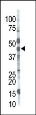 MGAT1 (N-term)