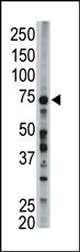 FACL6