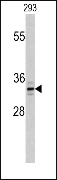 PPT1