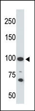 ACE2 (SARS Receptor)
