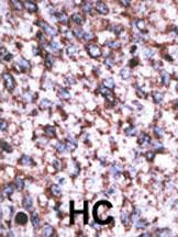 Rabbit Polyclonal Antibody to BACE2C