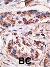 Rabbit Polyclonal Antibody to MAGEA1