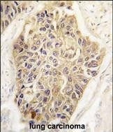 Rabbit Polyclonal Antibody to MAGEA1