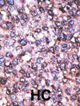 Rabbit Polyclonal Antibody to MAGED2