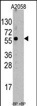 HSC70 Interacting Protein HIP (ST13)