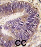 Rabbit Polyclonal Antibody to HSC70 Interacting Protein HIP (ST13)