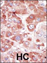 Rabbit Polyclonal Antibody to GRK7