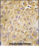 Rabbit Polyclonal Antibody to GRK7