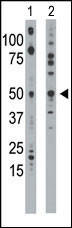 Ethanolamine Kinase (EKI1) (N-term)
