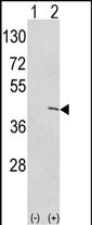 Rabbit Polyclonal Antibody to Ethanolamine Kinase (EKI1) (N-term)