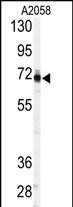 PAPSS1 (C-term A607)